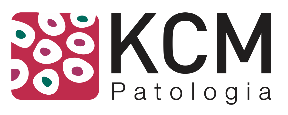 kcm
