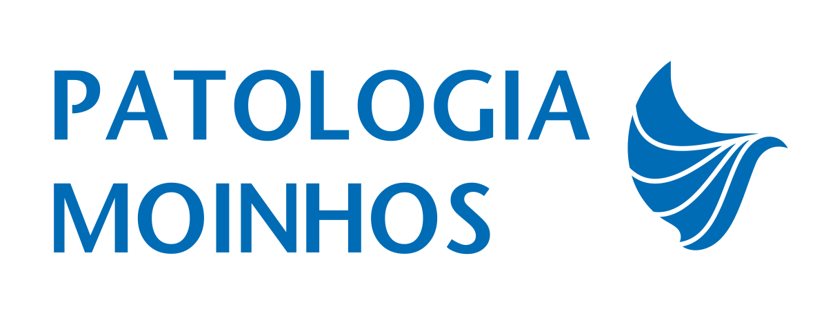 moinhos